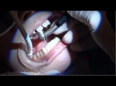 What They Don’t Want You To Know: Fluoride