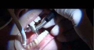 What They Don’t Want You To Know: Fluoride