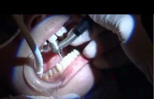 What They Don’t Want You To Know: Fluoride